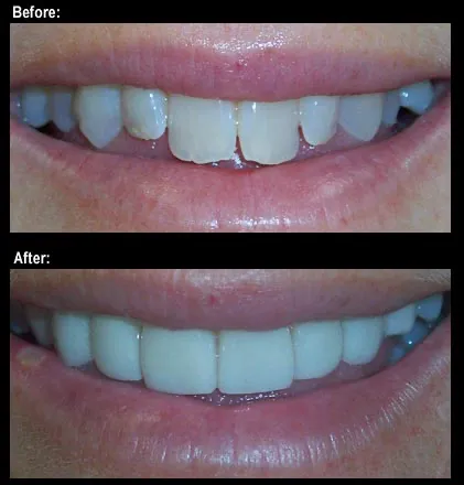 Case_2