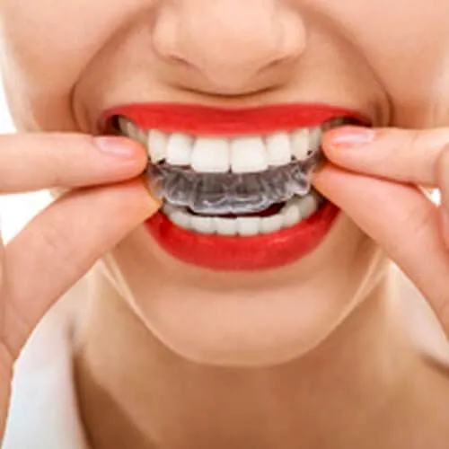 Hendersonville Dental Braces